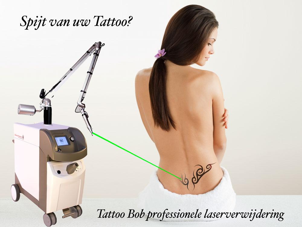 Tattoo verwijderen bij Tb medical!